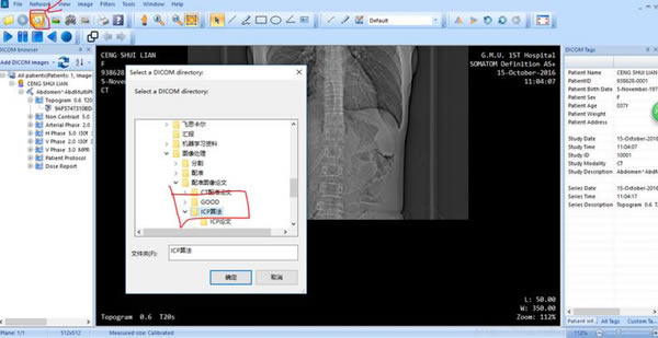 MicroDicomءMicroDicom(ҽѧͼ) V2.9.2 Win32λ