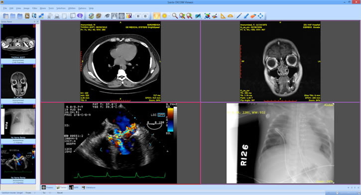 Sante DICOMİءSante DICOM Viewerİ v8.1.3 ر