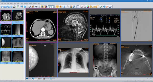 Sante DICOM Viewer-t(y)kܛ-Sante DICOM Viewerd v11.8.6ٷʽ